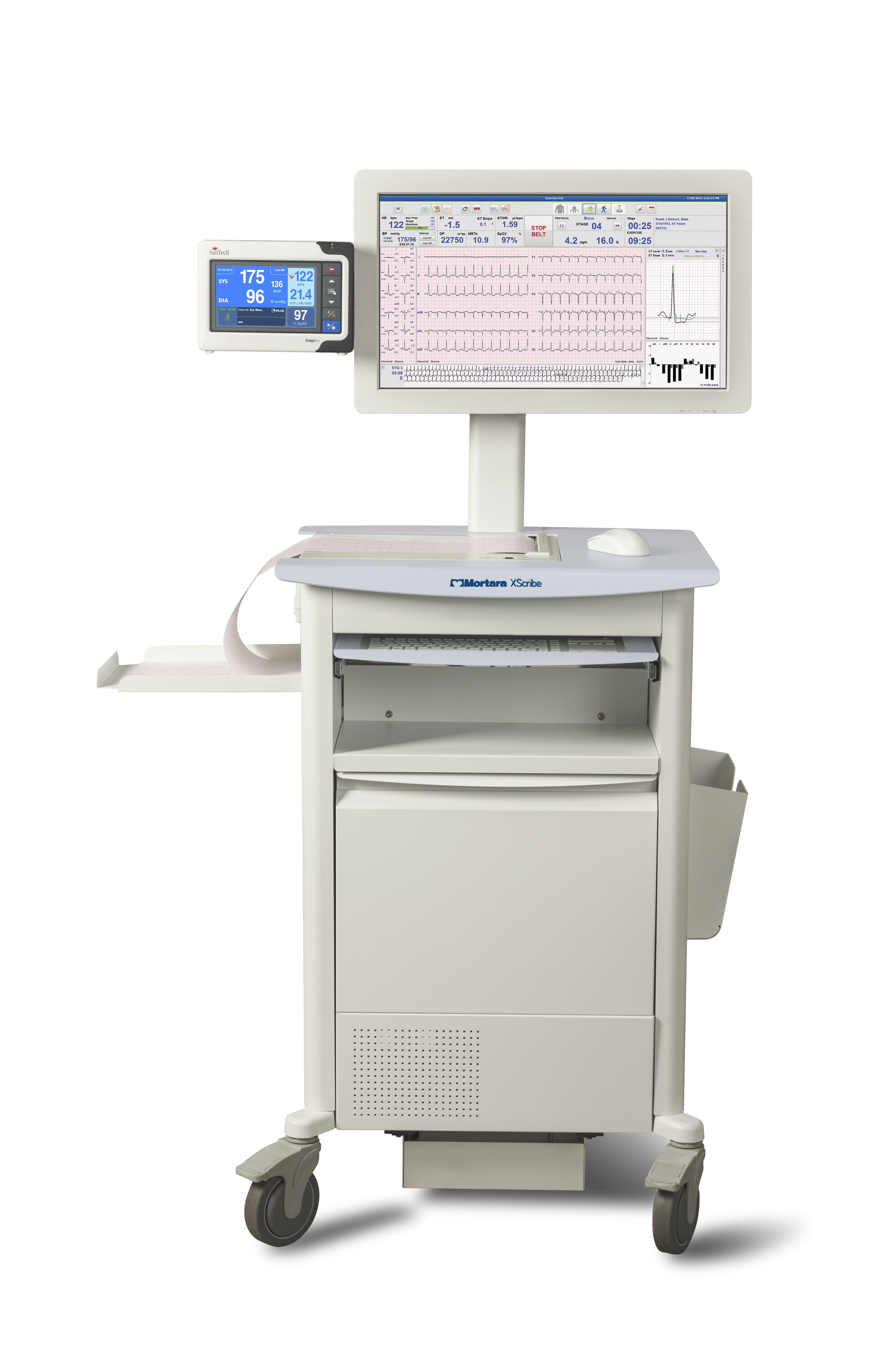 Mortara X-scribe Mortara X-scribe